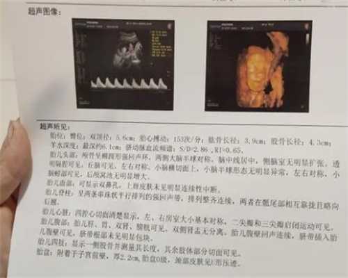 武汉第三代试管医院排名哪家最好？-助孕供卵代生